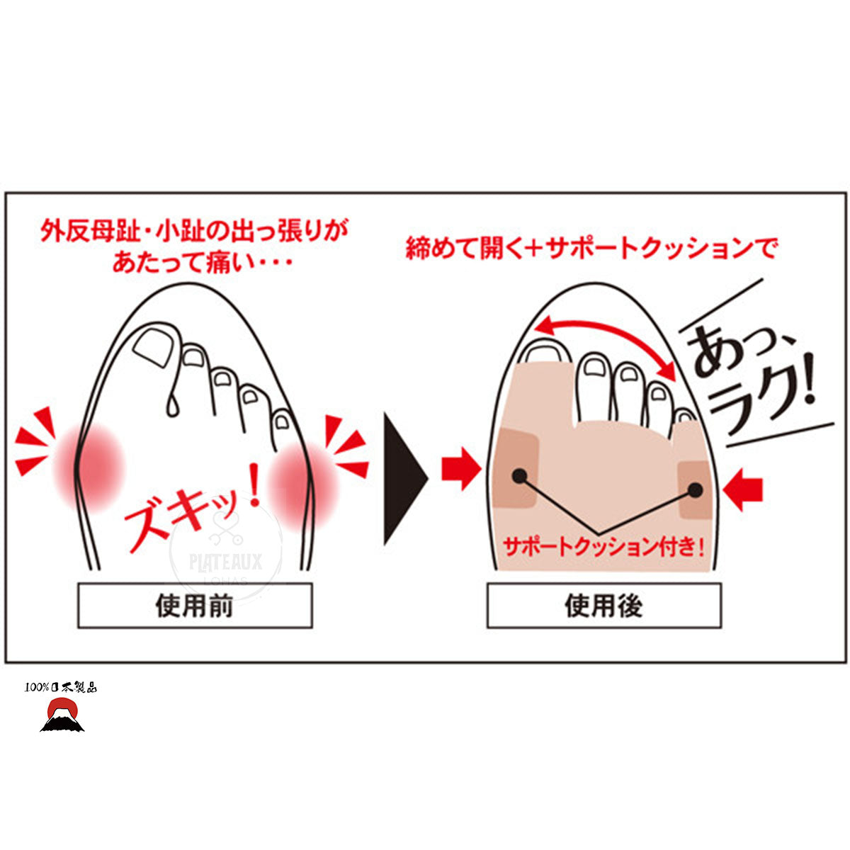 拇趾外翻矯正墊 |日本製造