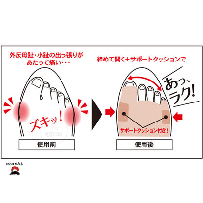 拇趾外翻矯正墊 |日本製造